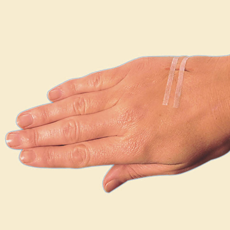 Strip ng Pagsara ng Balat